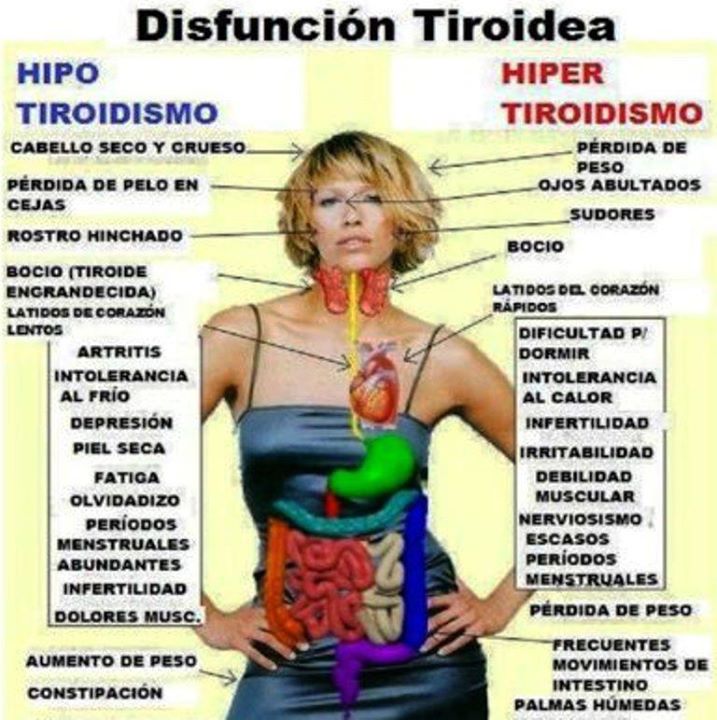 Disfunción Tiroidea