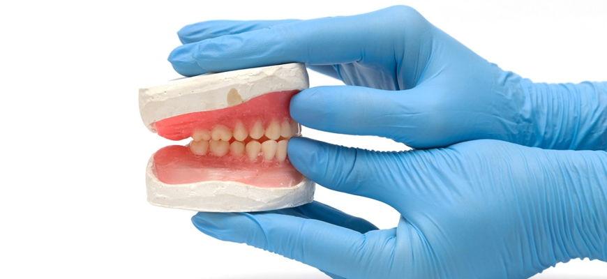 5 falsos mitos sobre las prótesis dentales