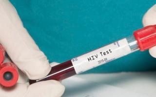 ¿Qué es el VIH?